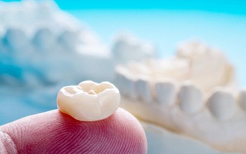Closeup of person holding dental crown next to mold of teeth