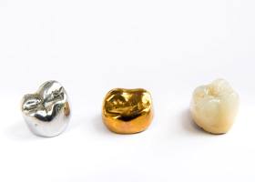 3 dental crowns made of various materials