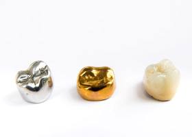 3 dental crowns made of various materials