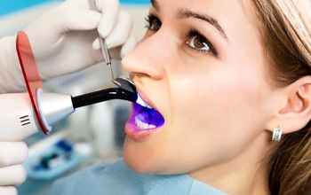 young woman getting her direct bonding hardened with curing light