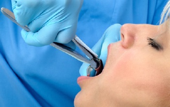Closeup of patient having tooth removed