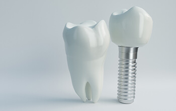 Model tooth next to dental implant in Rochester