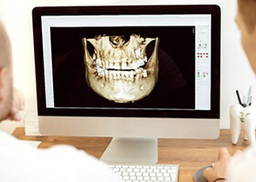 Dentist planning advanced dental implant treatment in Rochester