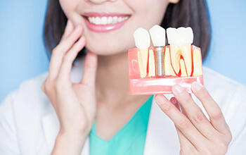 Rochester implant dentist holding model of dental implants in Rochester