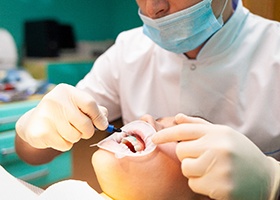 Female patient receiving in-office teeth whitening