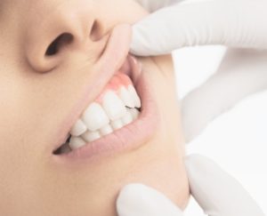 teeth gum dentist