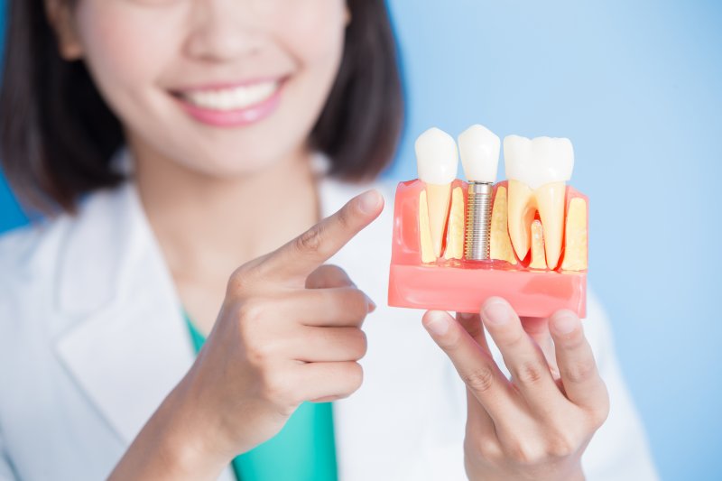 Dentist pointing to model of dental implants 