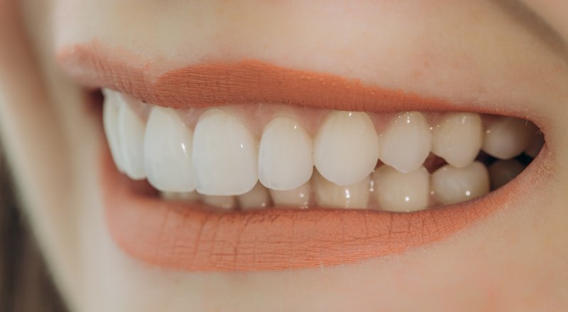 Closeup of woman smiling with veneers