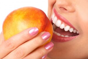 Woman with veneers biting into fruit